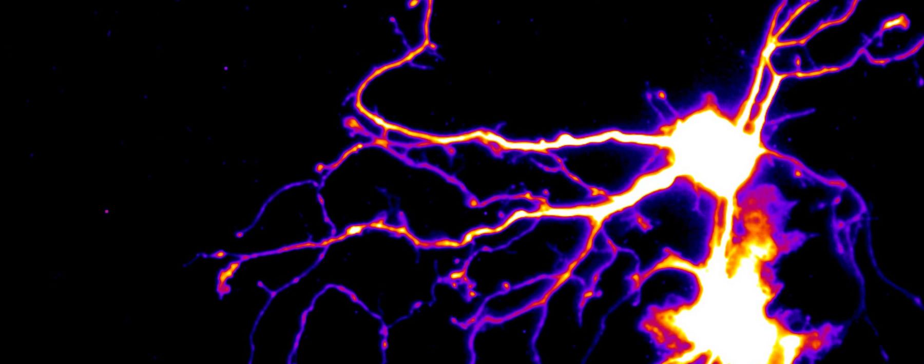 A neuron and glia expressing a photo-convertible protein, Dendra2.