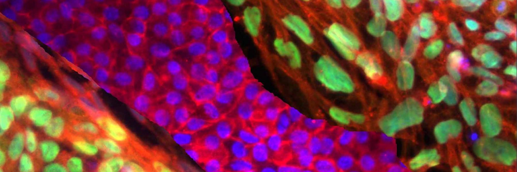 Stem cells. Credit: Teisha Rowland & Clegg Lab