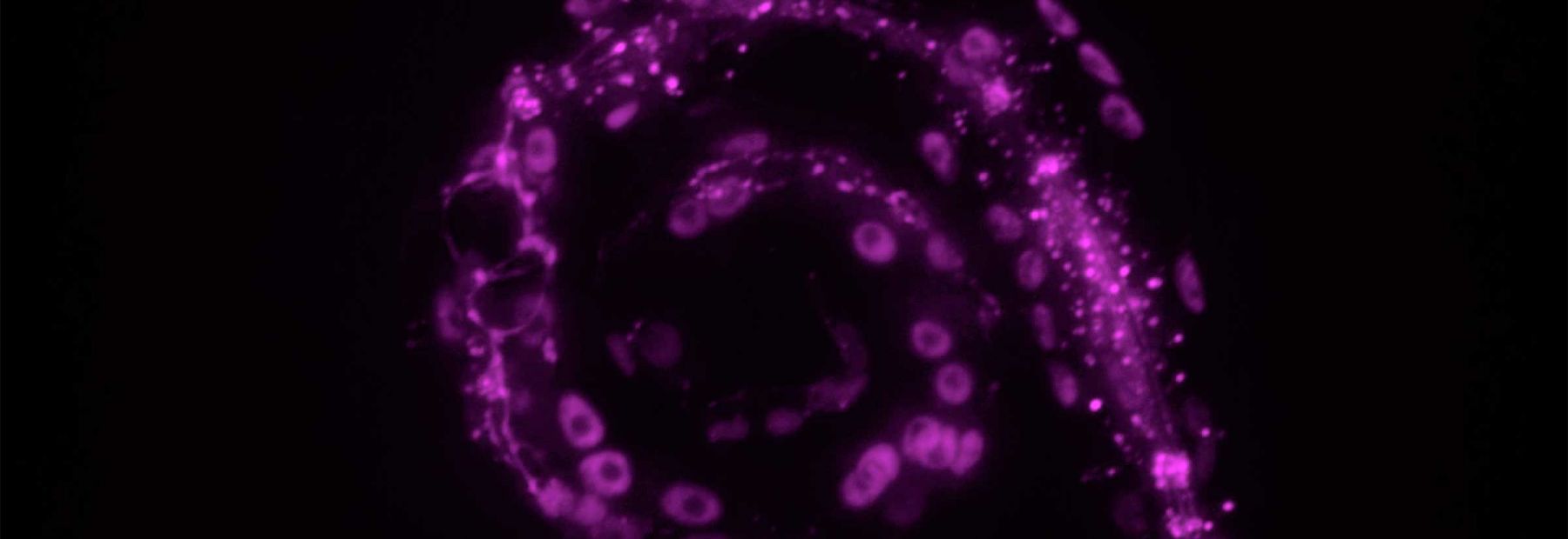  C. elegans with the digestive tract and muscle cells labeled with fluorescent marker. 