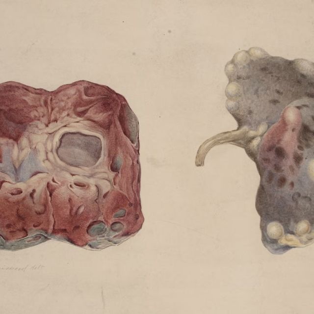 Credit: Wikimedia Commons