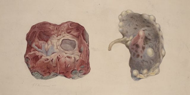 Credit: Wikimedia Commons