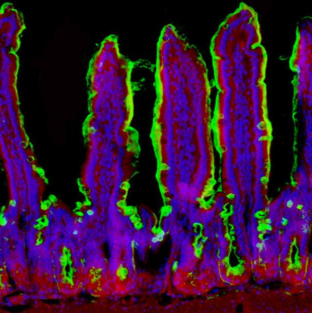 Salmonella food poisoning causes chronic intestinal inflammation (bright green) via disrupting the body's ability to detoxify resident gut bacteria.