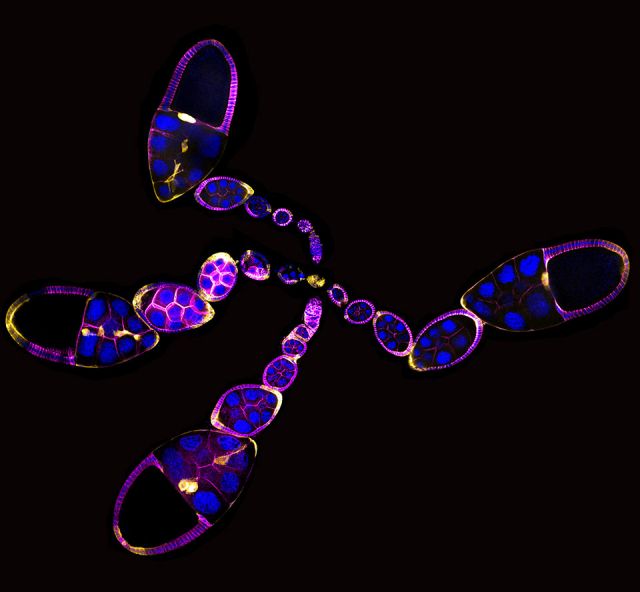 Picture of Drosophila egg chambers. Credit: Dr. Joseph Campanale