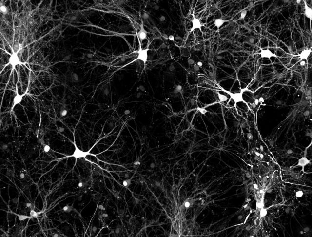 Structure of mature 2D neuronal network. Credit: Elmer Guzman