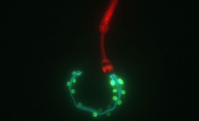 C. elegans worms showing pharynx (red) and intestine ("endoderm" in green and cyan) portions of the digestive tract. Credit: Pradeep Joshi