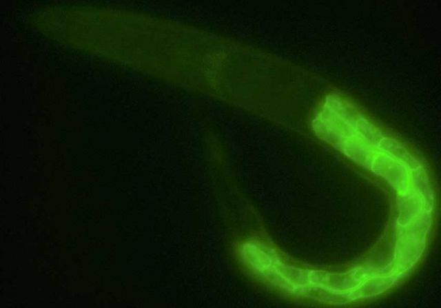 C. elegans with marker labeling the membrane of the gut cells.