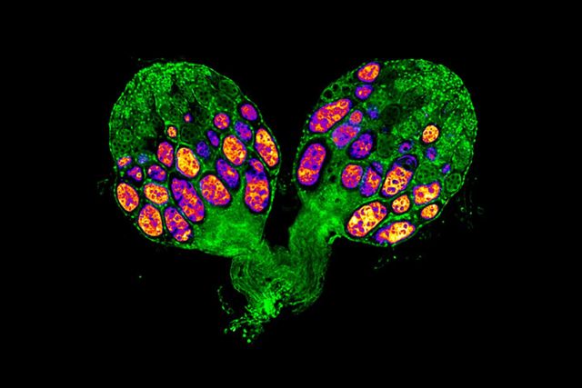 Ovary from a diapausing fruit fly showing arrested egg development.