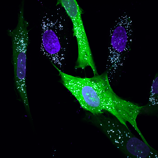 endoplasmic reticulum