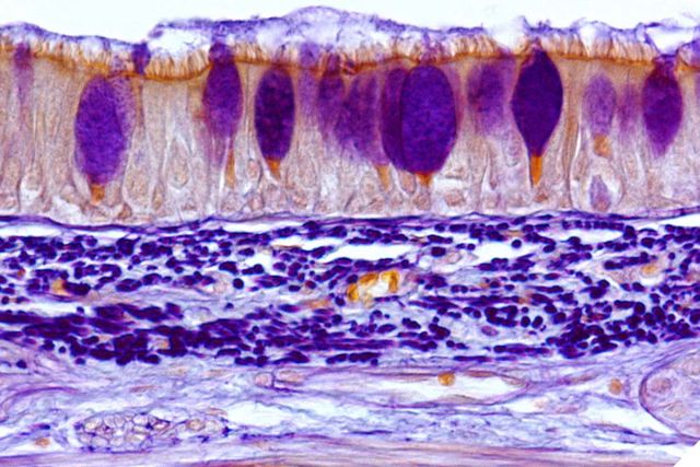The respiratory airway is lined with beating ciliated cells (the orange hairlike projections) over which a layer of mucus flows. The combination serves to trap and move foreign bodies, including bacteria, in the airway
