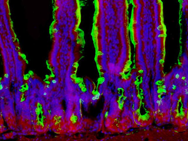 Gut Reaction image.jpg  Salmonella food poisoning causes chronic intestinal inflammation.