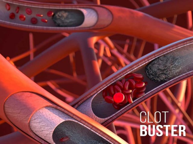 Clot Buster