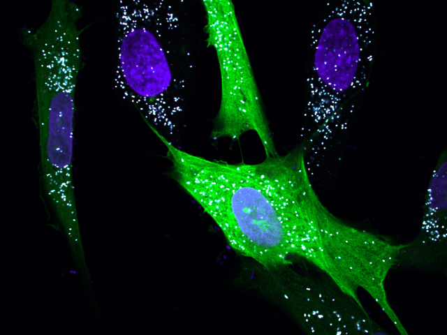 endoplasmic reticulum