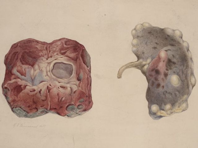 Credit: Wikimedia Commons